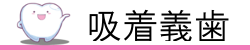 吸着義歯トップ